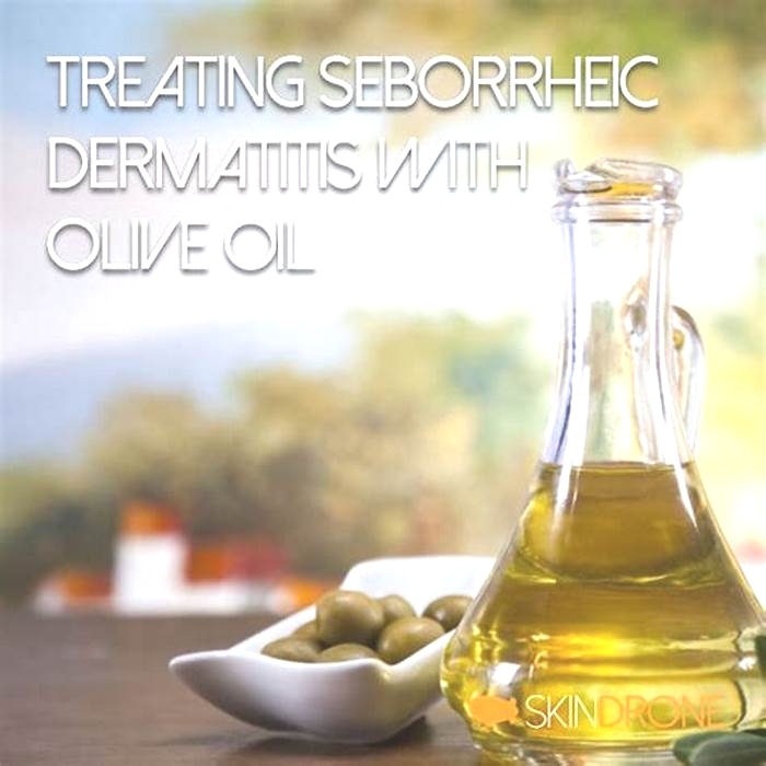 Can I put oil on seborrheic dermatitis?