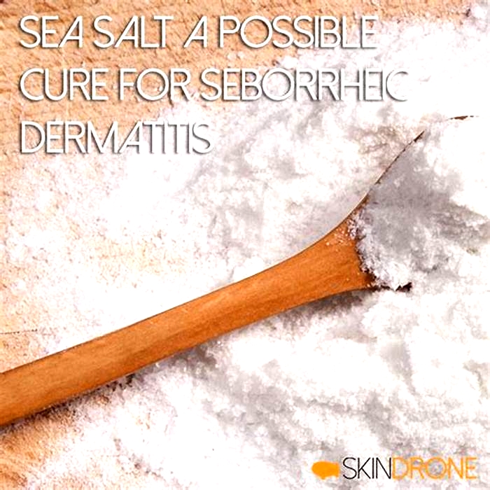 Can salt cure seborrheic dermatitis?