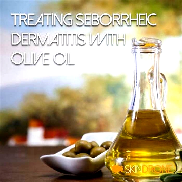 Does applying oil worsen seborrheic dermatitis