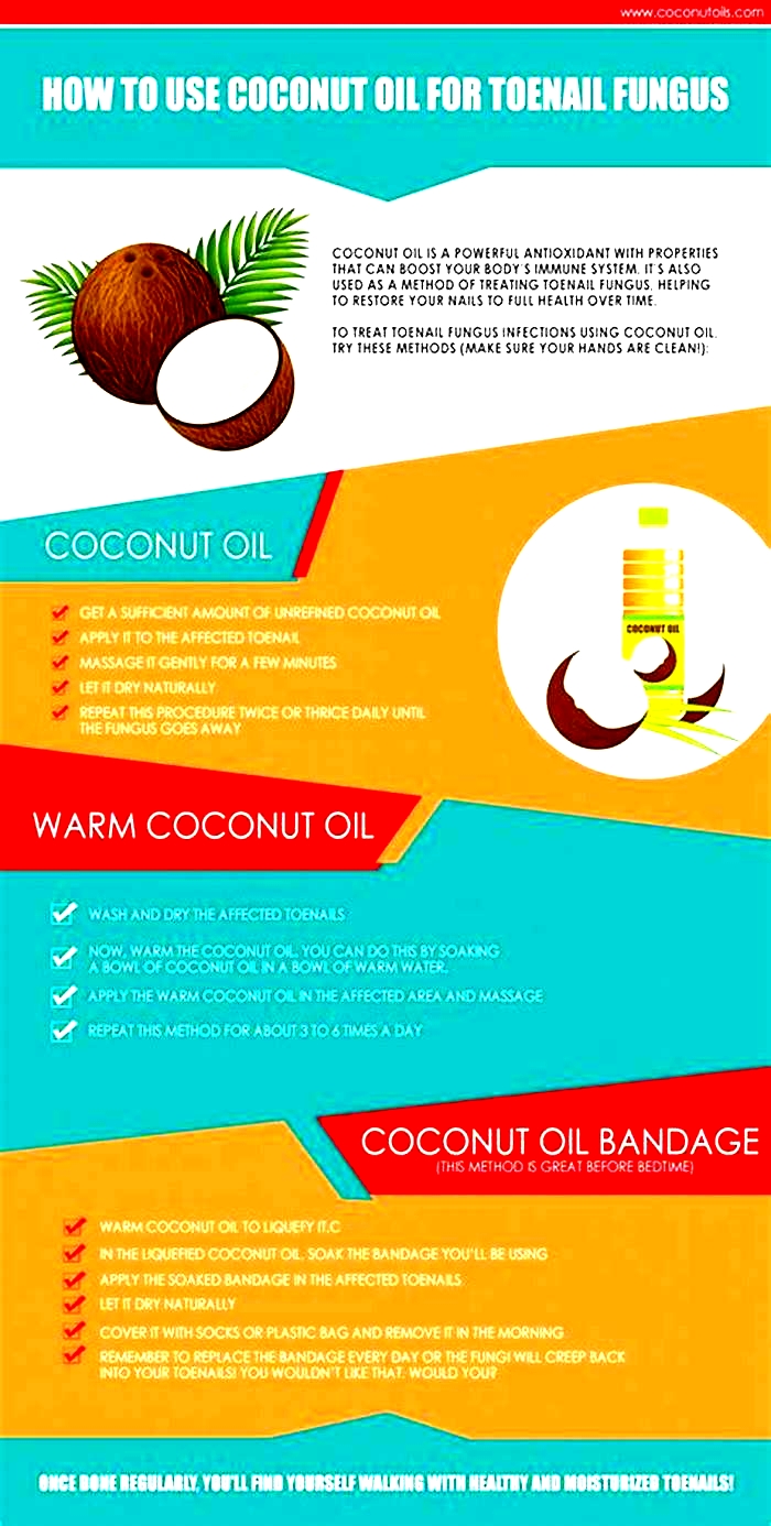 Does coconut oil treat fungal infections?