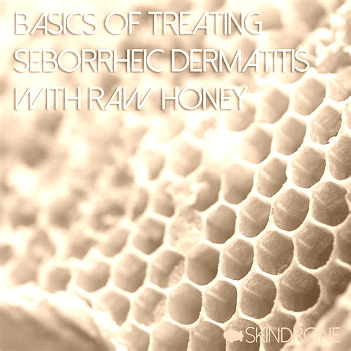 Does honey cure seborrheic dermatitis?