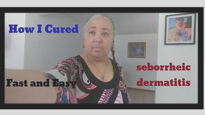 How can seborrhea be cured