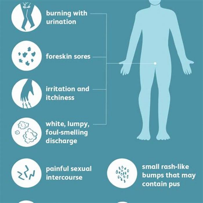 How do I know if my groin rash is fungal