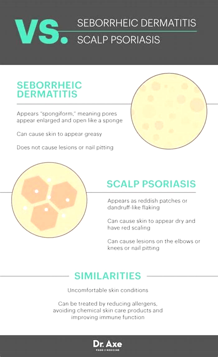 How do you clean seborrhea?