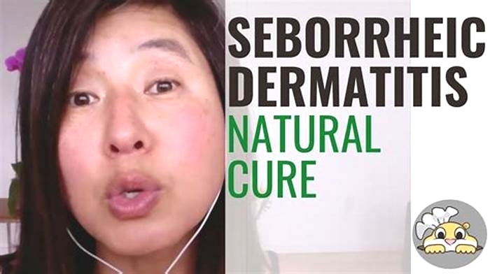 How do you get rid of seborrheic dermatitis permanently?