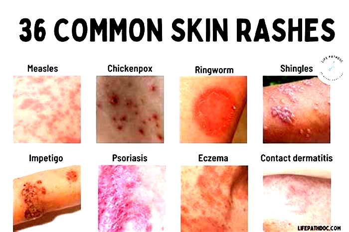 How do you know if a rash is serious?