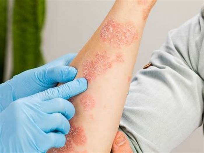 How to tell if a rash is serious?