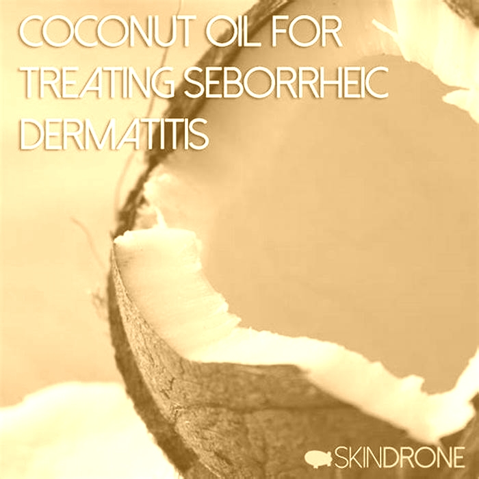 Is coconut oil good for seborrhea