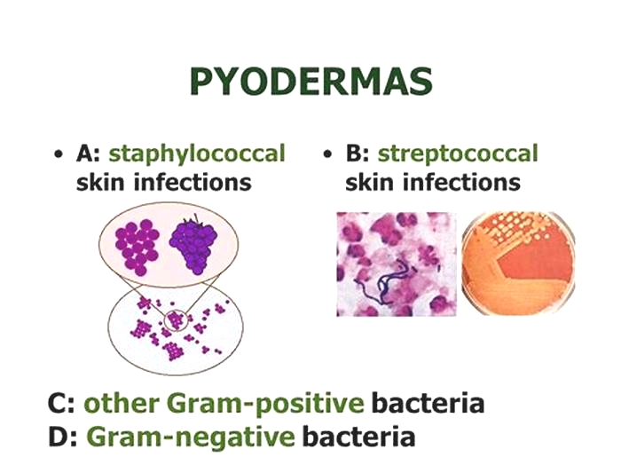 Is pyoderma bacterial or fungal?