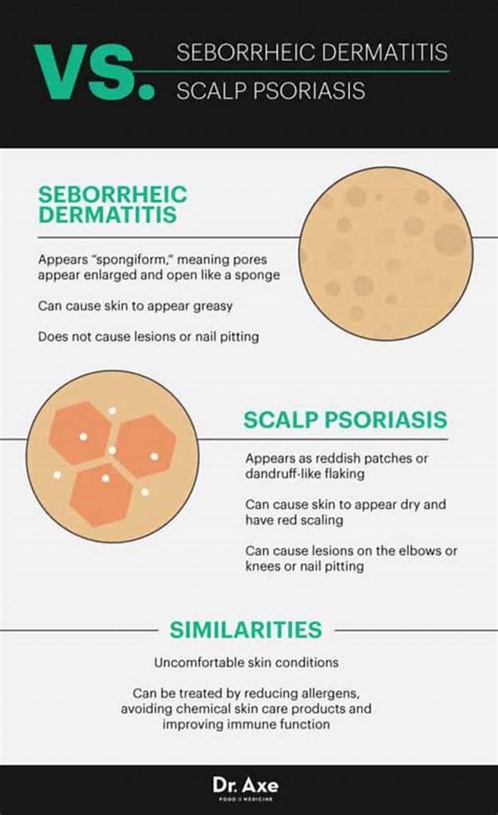 Is seborrheic dermatitis a vitamin deficiency?