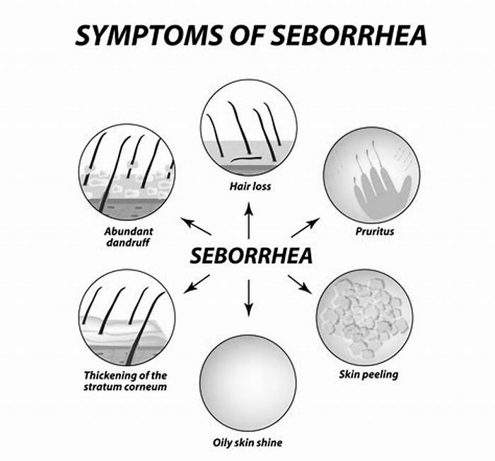 What can cause seborrhea