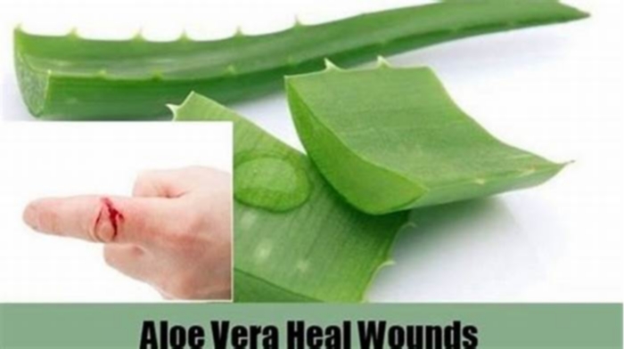 What happens if you put aloe vera on an open wound