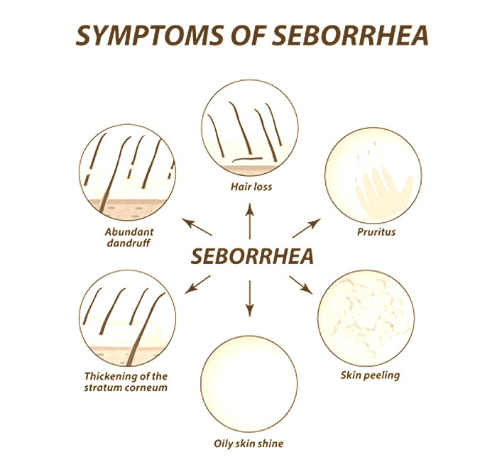 What triggers seborrhea?